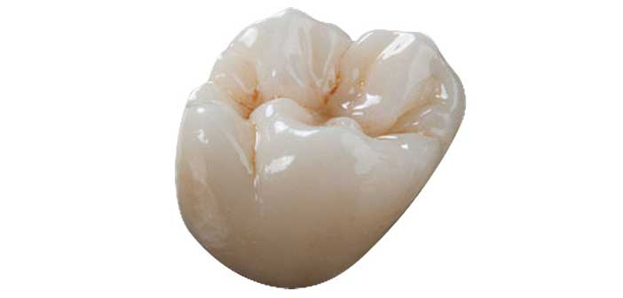 Couronne zircone